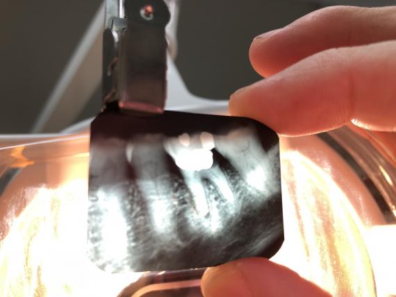 牙痛怎辦 逃兵經驗分享 練習和自己一起變老文 段鍾沂 滾石文化董事長 讀後感 Peopo 公民新聞