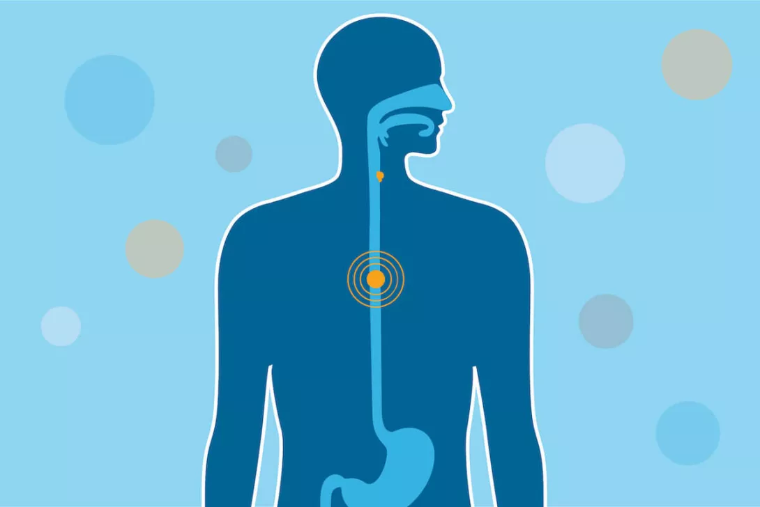 -Esophagal-Cancer-