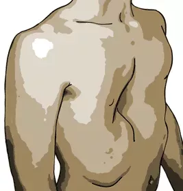 img_pectus_chest_illustration.gif